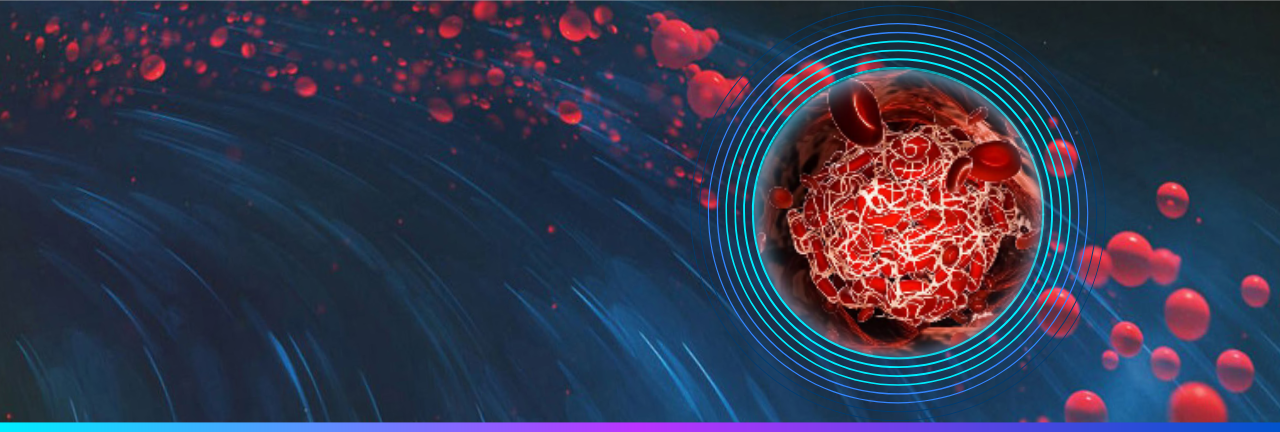 Exclusive Session on Pulmonary Embolism Banner