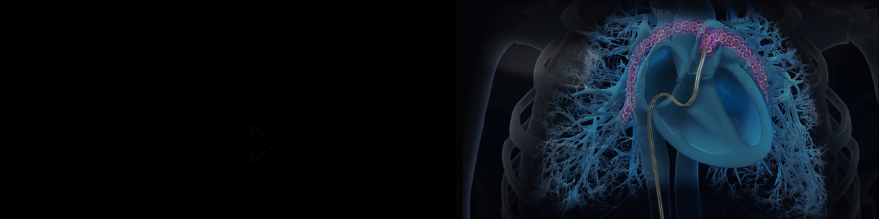 Pulmonary Embolism Learning Hub webpage banner