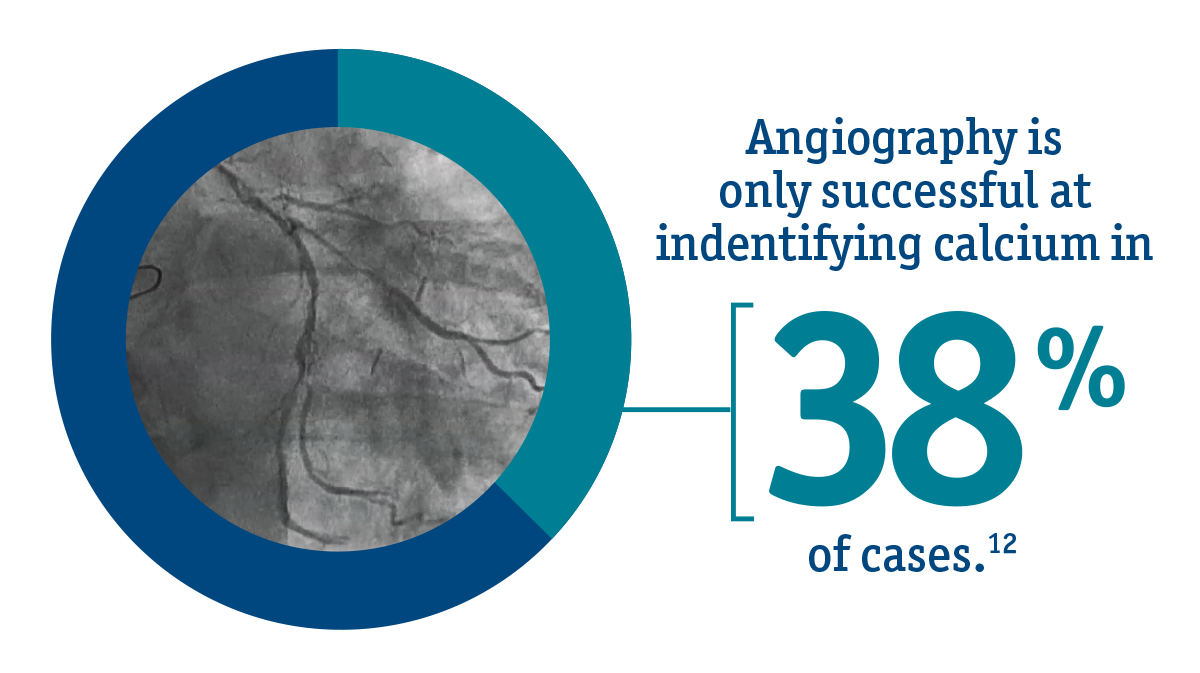 Angiography, for example, is successful at identifying calcium in only 38% of cases – essentially only effective in the most severe cases. 