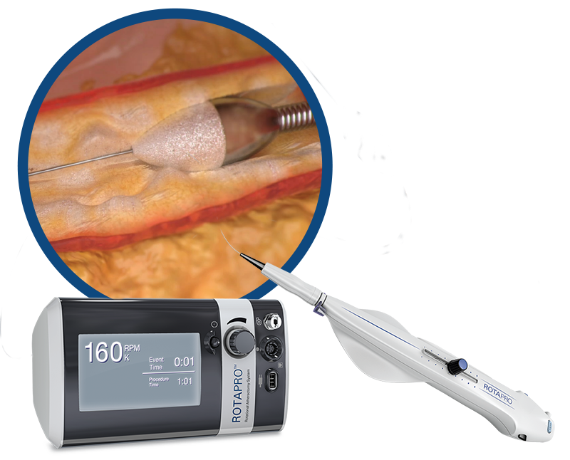 Learn more about ROTAPRO™