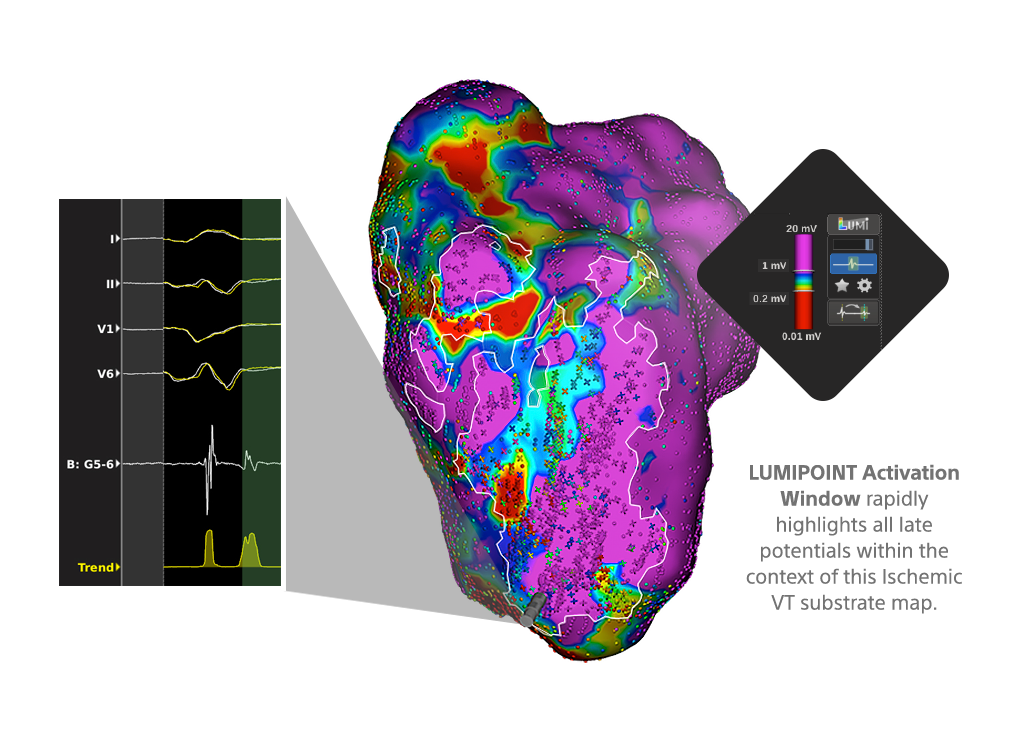 Lumipoint Simple Activation