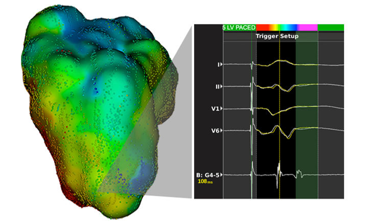 Initial Activation Map of LV Substrate, paced from RVA.