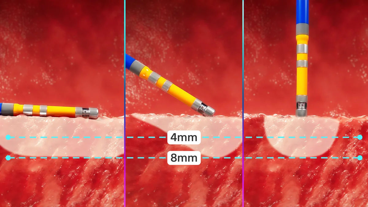 Transform focal procedures