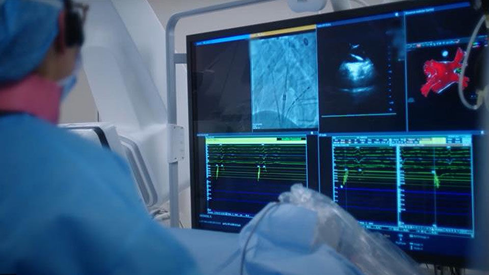 Physician in lab viewing a predictable, reproducible FARAPULSE workflow.