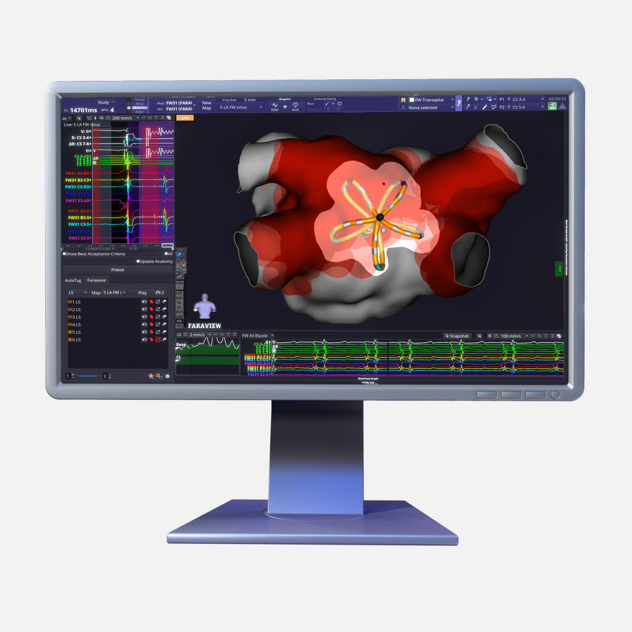 The FARAVIEW Software Module dynamically visualises FARAWAVE NAV PFA catheter size, shape, and rotation for cardiac mapping.