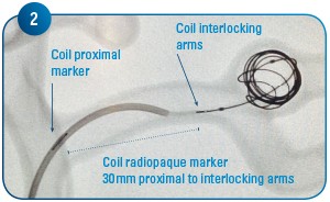coil-delivery 2