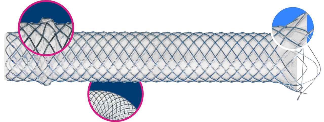 wallflex-plus-with-callouts