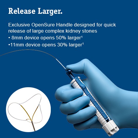 Release Larger. Exclusive OpenSure Handle designed for quick release of large complex kidney stones. | • 8mm device opens 50% larger(1) •11mm device opens 30% larger(1)