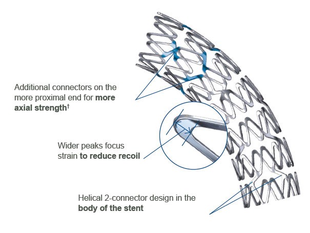 Customized Stent Architecture