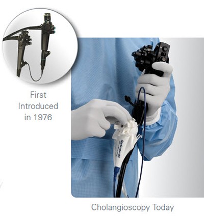 First cholangioscope and tools for today's cholangioscopy
