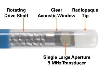 ICE Catheter Tip Labeled
