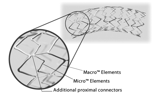 Express SD features a patented Tandem Architecture™ Stent Design