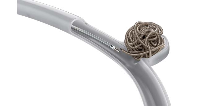 EMBOLD™ Detachable Coil System image