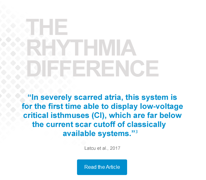 THE RHYTHMIA HDx DIFFERENCE