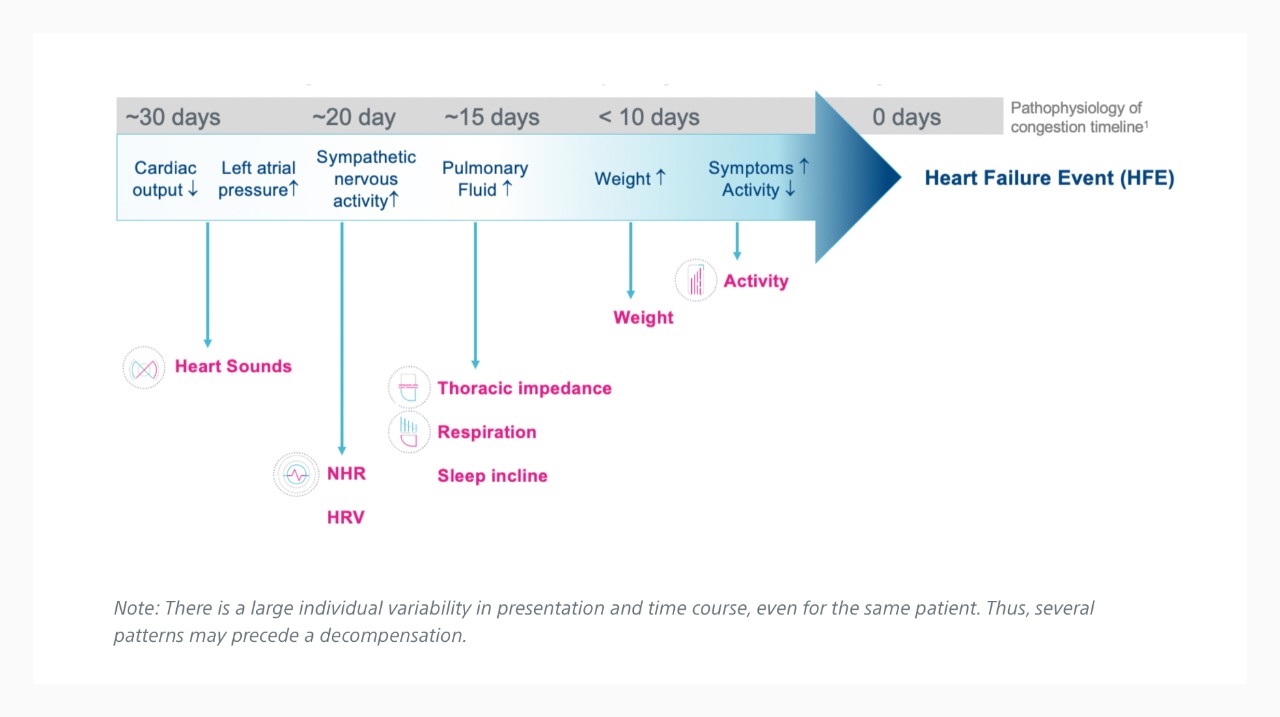Timeline showing an example time course of heart failure decompensation.