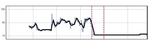 HeartLogic Trend Graph for Mean Heart Rate