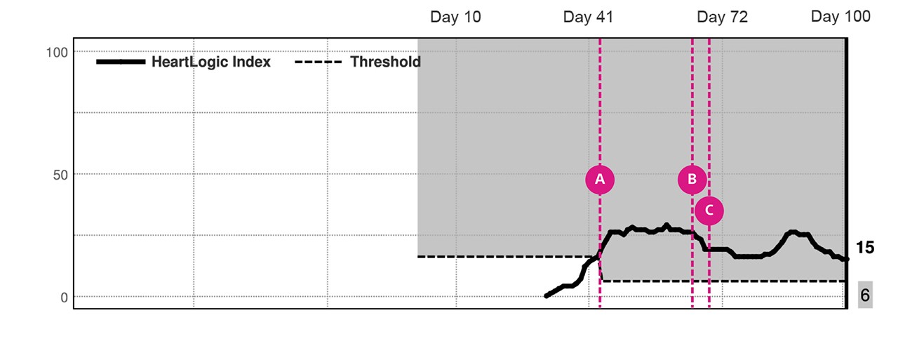 HeartLogic Composite Trend Index Graph