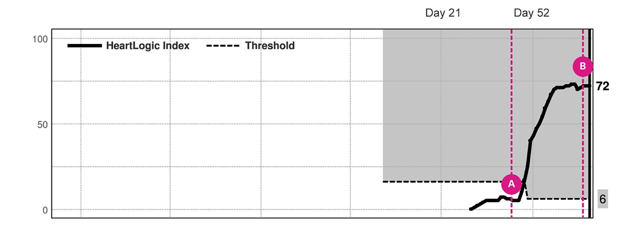 HeartLogic Composite Trend Index Graph