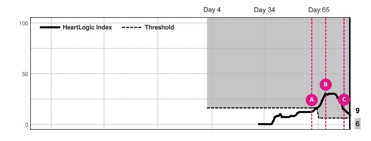 HeartLogic Composite Trend Index Graph