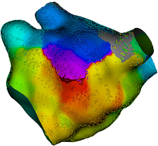 Isolated multicolor cardiac map generated by RHYTHMIA HDx