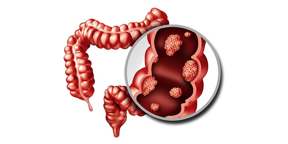 Intestinal tract