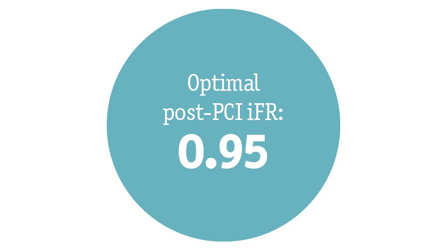 Optimal post-PCI DFR:  0.95