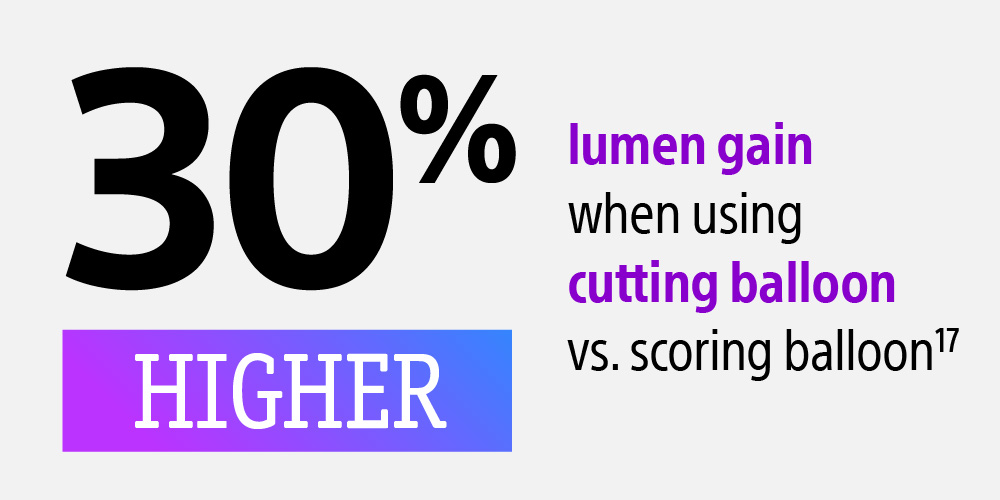 Thirty percent higher lumen gain when using cutting balloon compared with scoring balloon.