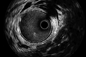 Screenshot of a screen in the IVUS + Physiology Pro app.