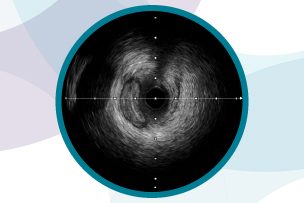 Example IVUS image.