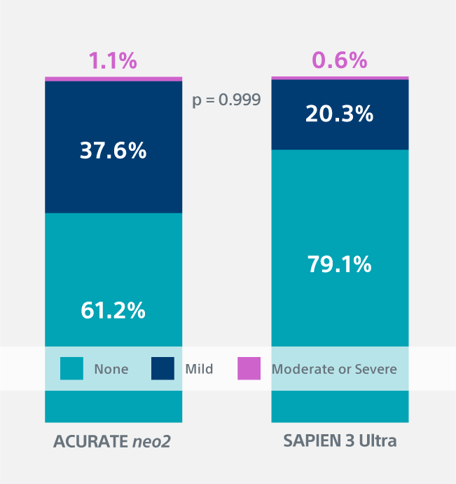 Chart showing comparison between Acurate neo2 and Sapien 3 Ultra