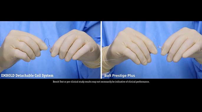 Hands wearing surgical gloves feeding wire 