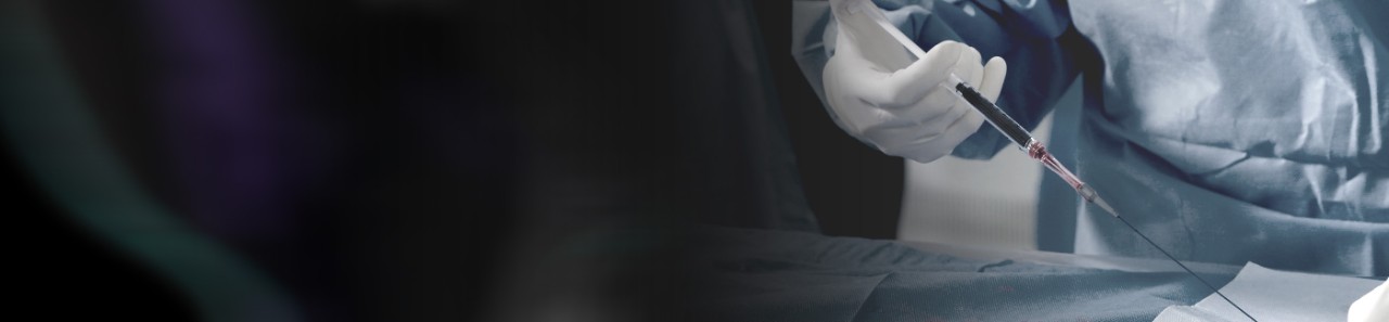 Gloved hand administering Obsidio Conformable Embolic.