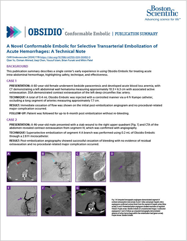  Obsidio  Embolic UChicago publication summary