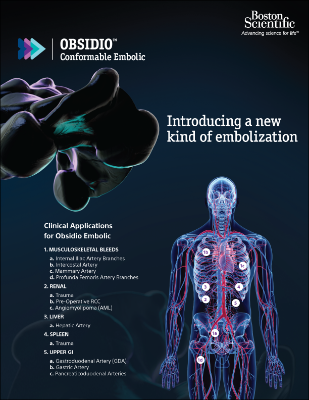  Obsidio Conformable Embolic clinical application.
