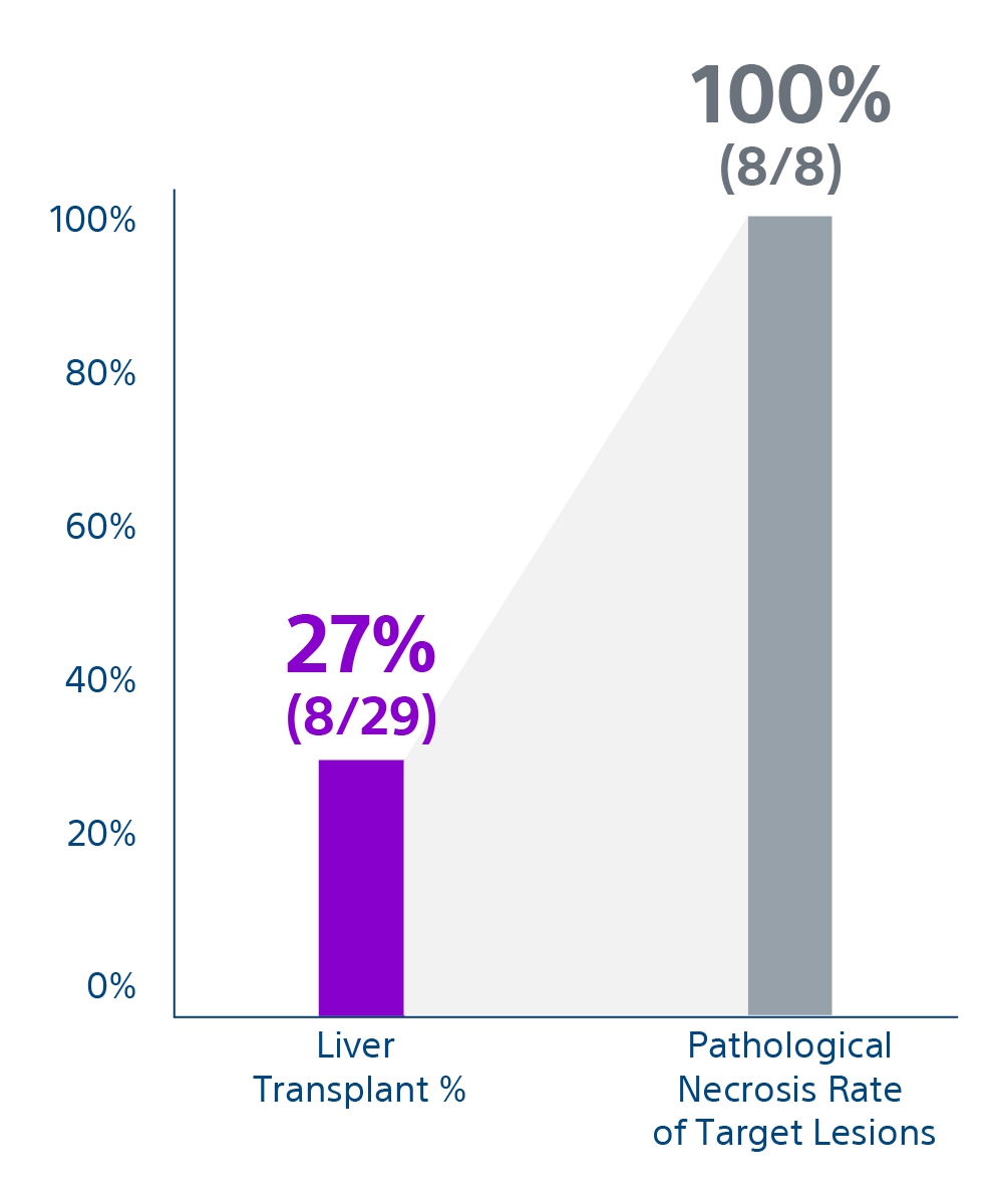 Graph showing 27% (8/29) liver transplant % and 100% (8/8) pathological necrosis rate of target lesions.