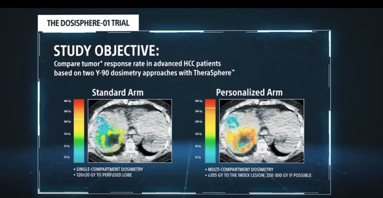 DOSISPHERE-01 Trial Data.