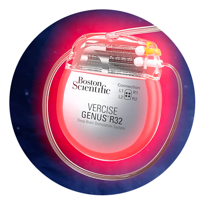 Vercise Genus R32 IPG.