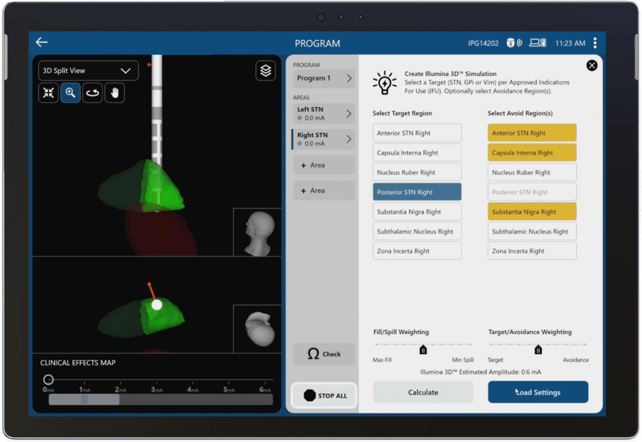 Vn5 software menu selecting "Create Illumina 3D Simulation".