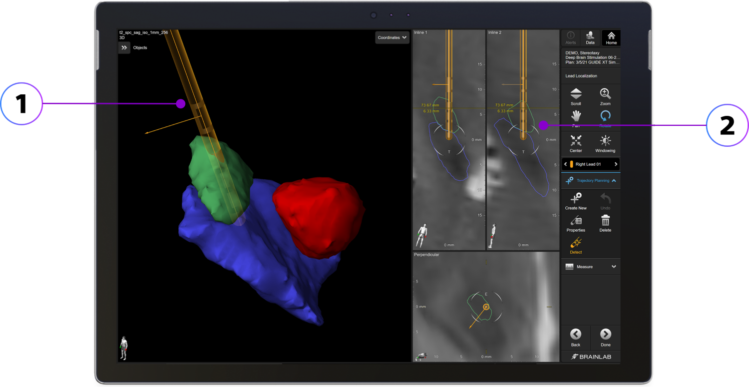 Image Guided Programming Boston Scientific