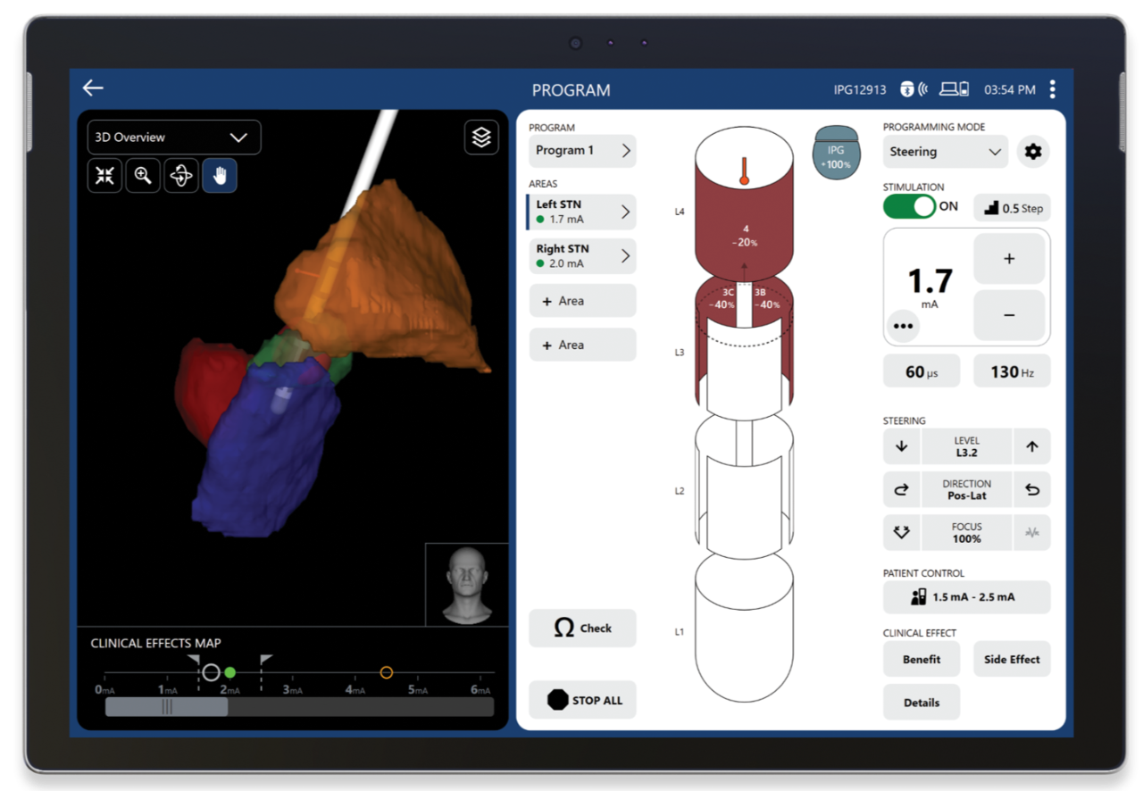 Tablet with Vercise Neural Navigator 5 Software showing a split screen of deep brain stimulation lead orientation and programming options.