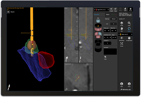 Tablet showing Vercise Neural Navigator 5 Software with Guide XT for pre-planning therapy based on patient's specific anatomy.
