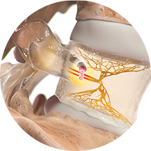 Image showing a close-up view of the basivertebral nerve.