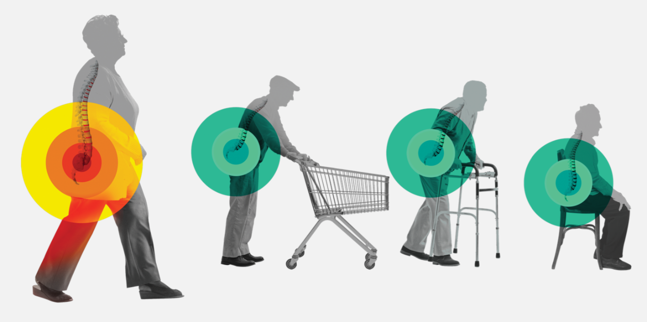 Woman shows LSS extension; Standing and walking provokes pain and weakness in legs. Two men push shopping cart and lean on walker, showing “shopping cart” syndrome; Leaning forward can make walking more comfortable. Woman shows LSS flexion; sitting may relieve symptoms.