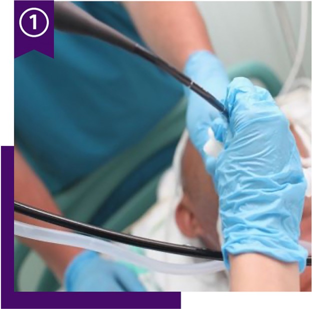 Healthcare workers place airway stent in patient in operating room, with ribbon icon and number 1