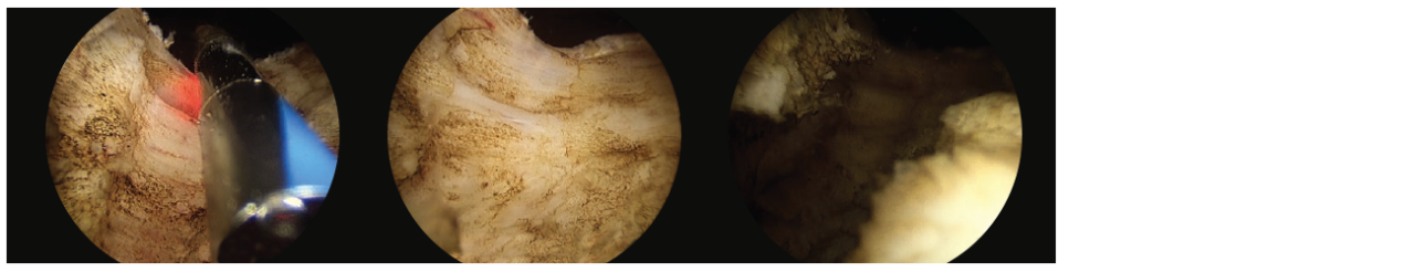3 scope images. Identifying how to vaporize a working space.
