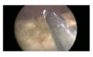 GreenLight demonstration.