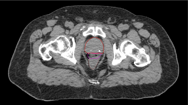 SpaceOAR-CT image.