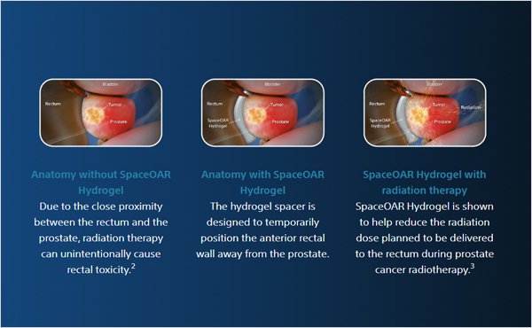 Preview of the SpaceOAR Product and Procedure webpage.