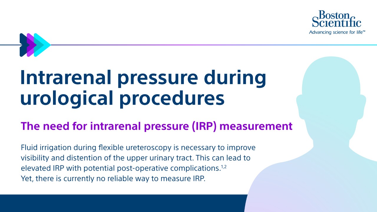 Intrarenal Pressures During Urological Procedures Infographic
