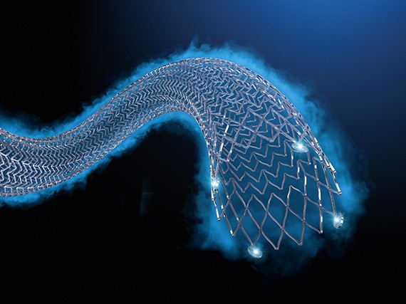 Visualization of Eluvia Drug-Eluting Stent, with drug emanating from it.